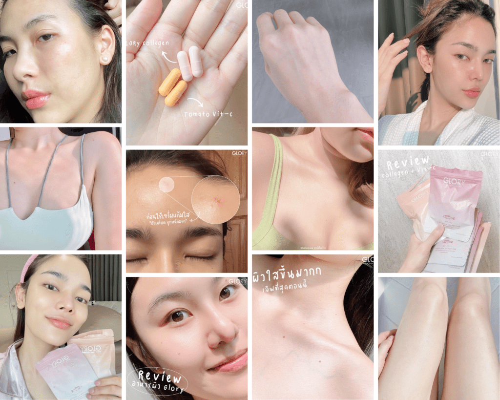 gloryreviewรีวิวผิวใส